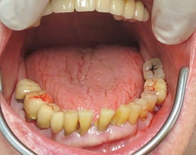 Img 0746 iodxju - Eugenol