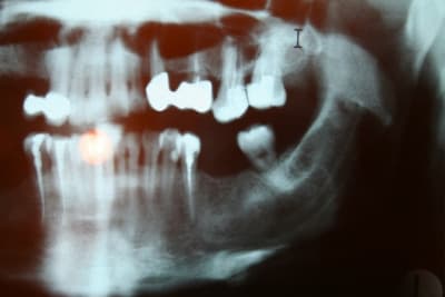 Img 0812 small csu6w5 - Eugenol
