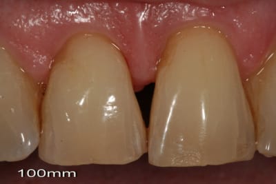 Img 0814 m22moy - Eugenol