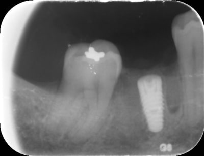 Img 0817 kzosa4 - Eugenol