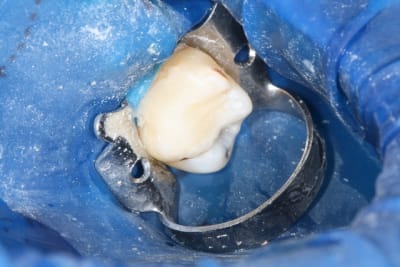 Img 0872 dtrb6c - Eugenol