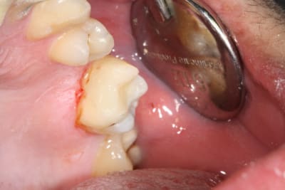 Img 0874 lnqnq1 - Eugenol