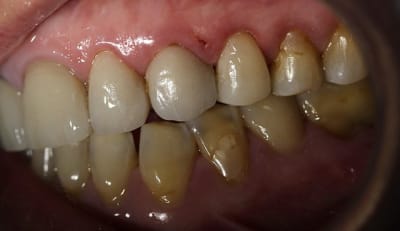 Img 0879   copie wia2os - Eugenol