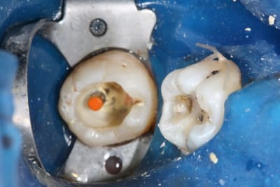 Img 0889 pt96wt - Eugenol