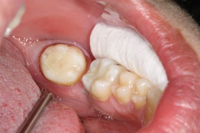 Img 0892 uyeuge - Eugenol