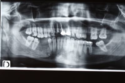 Img 0893 qiv2qz - Eugenol