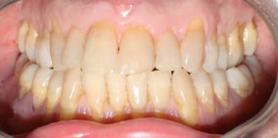 Img 0922 ibibom - Eugenol