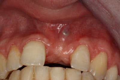 Img 1065 ochucd - Eugenol