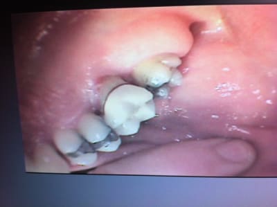 Img 1180 sxwo2r - Eugenol