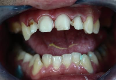 Img 1182 l0sdis - Eugenol