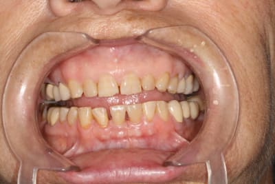 Img 1199 gnaa05 - Eugenol