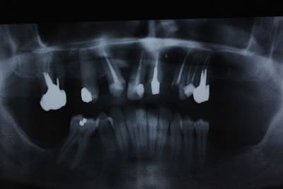 Img 1238 l0yaqw - Eugenol