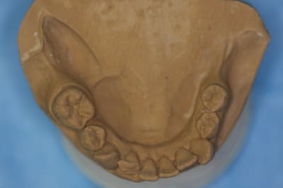 Img 1247 rvujh4 - Eugenol