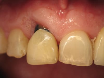 Img 1267 gt3e8f - Eugenol