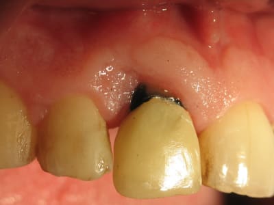 Img 1268 ofm4vi - Eugenol