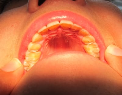 Img 1295 e28ziz - Eugenol