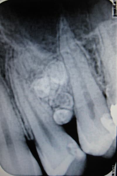 Img 1297 tkvosh - Eugenol