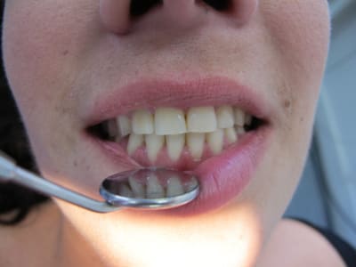 Img 1302 xode4w - Eugenol