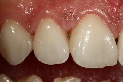 Img 1343 w53qjc - Eugenol