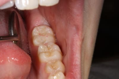 Img 1711 o2uqhz - Eugenol