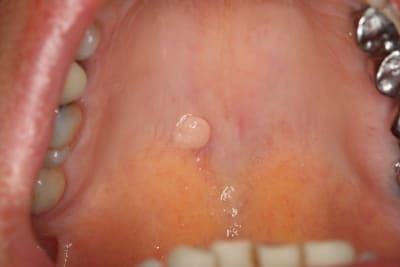 Img 1769 r3rhfb - Eugenol