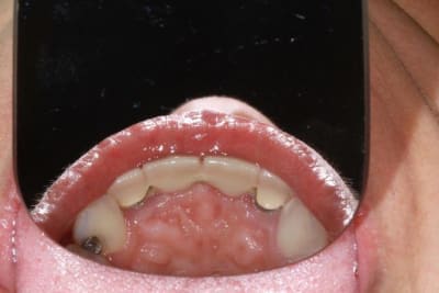 Img 1860 q3hq1a - Eugenol