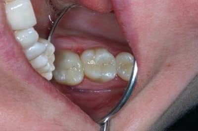 Img 1860 vuo3ky - Eugenol