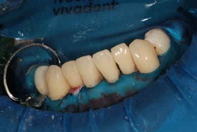 Img 2020w ev9848 - Eugenol