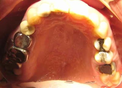 Img 2057   copie fi4ehh - Eugenol