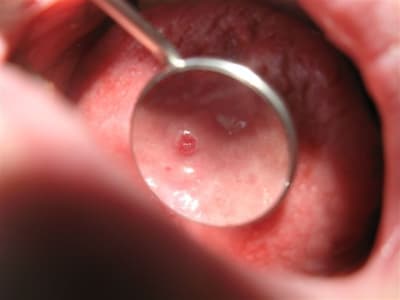 Img 2090 icjova - Eugenol