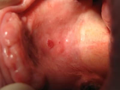 Img 2092 opu2l3 - Eugenol