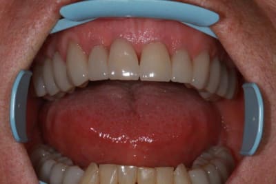 Img 2107 ox83wk - Eugenol