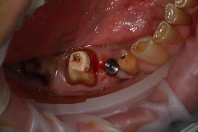 Img 2112 khqflc - Eugenol