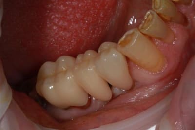 Img 2115 ypx3g5 - Eugenol