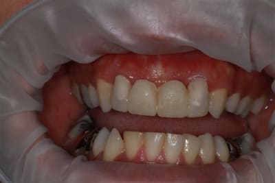 Img 2176 y7mrkt - Eugenol