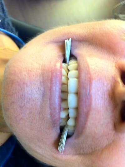 Img 2230 yh7jse - Eugenol