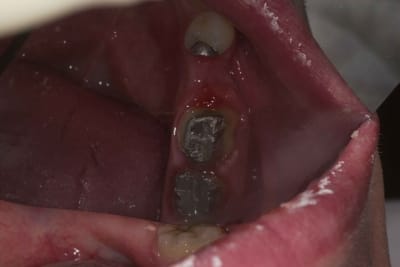 Img 2249 j8bycu - Eugenol