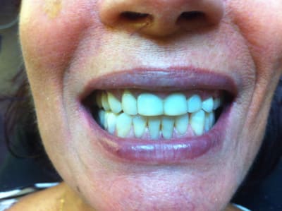 Img 2249 rhlqss - Eugenol