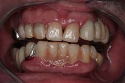Img 2251  800x600  iipyey - Eugenol
