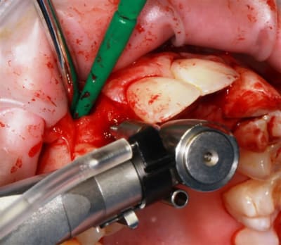 Img 2251 czgtlx - Eugenol