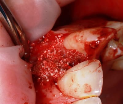 Img 2257 xgfqnp - Eugenol