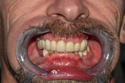 Img 2325 rtmgqe - Eugenol