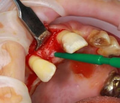 Img 2344 ut6zgx - Eugenol