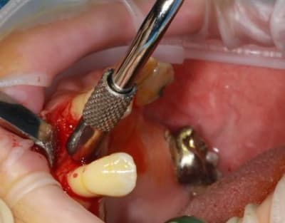 Img 2345 xbjsgs - Eugenol