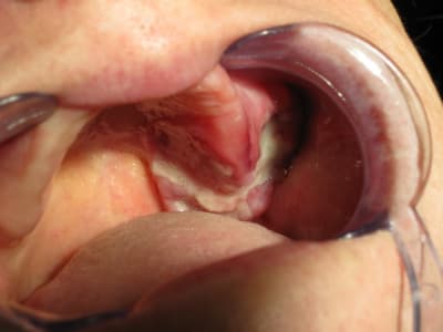 Img 2377 kwkqxa - Eugenol