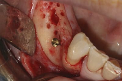 Img 2389 2 msmlxs - Eugenol