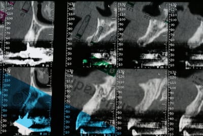 Img 2644 qpfxzv - Eugenol