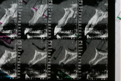 Img 2645 gcfhrm - Eugenol
