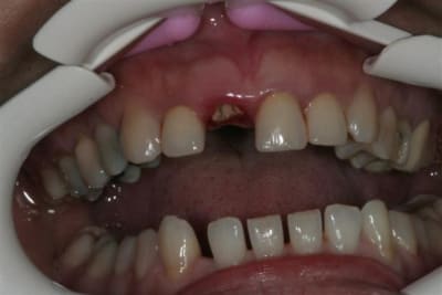 Img 2650  small  kuncqr - Eugenol