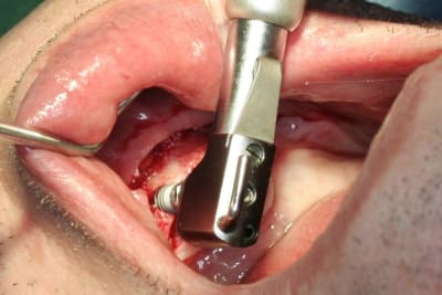 Img 2783 wyqsbt - Eugenol